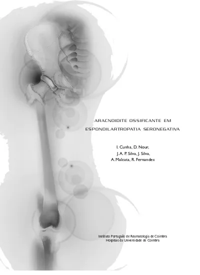 Hemianopsia Altitudinal Inferior Por Aracnoidite Optoquiasmatica